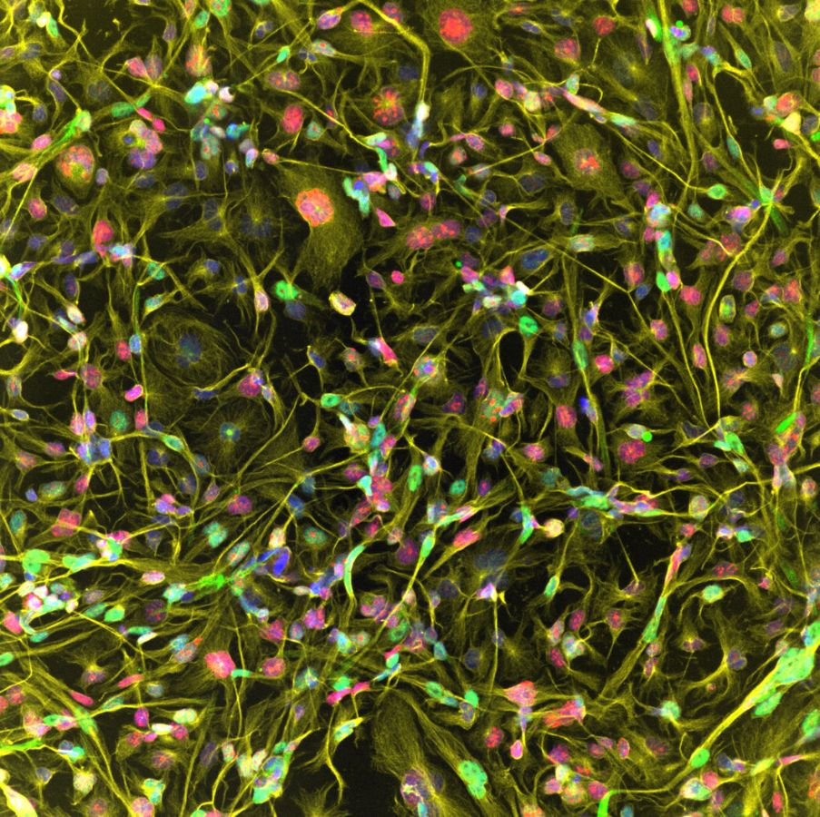 Microscopic identification of different tumor cell populations in sarcoma models using antibody staining